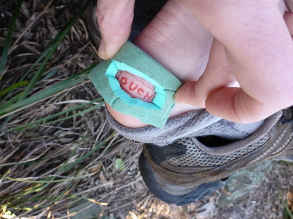 cach-chua-phong-rop-da-khi-di-trekking-do-mang-giay-chat-wetrekvn