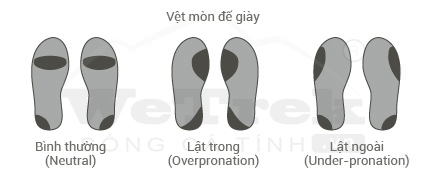 do-lat-ban-chan-pronation-wetrek.vn
