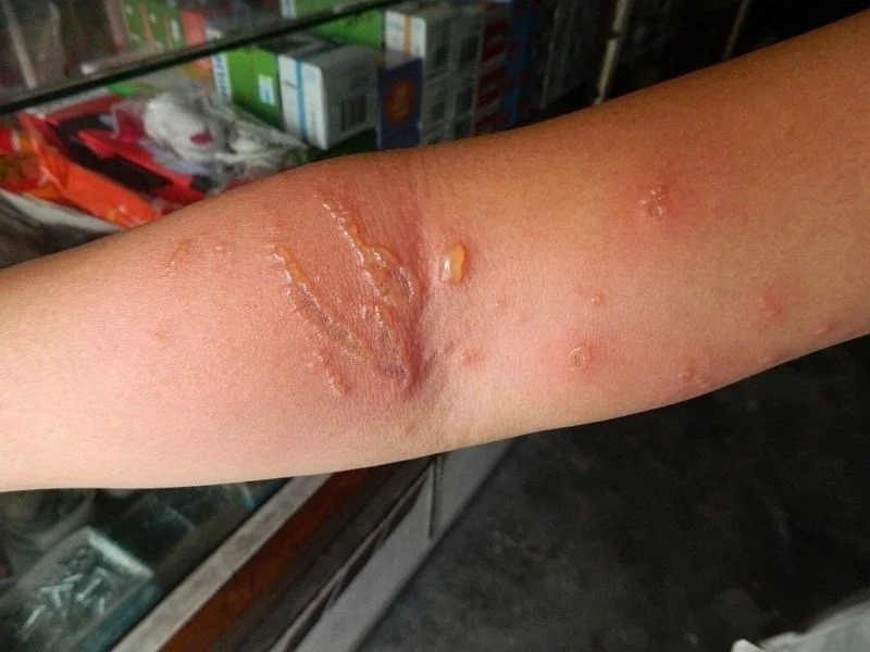 Bật mí cách phòng tránh những nguy hiểm tiềm tàng khi đi biển dành cho bạn6